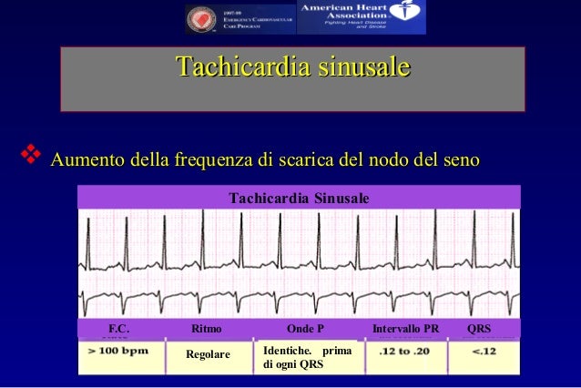 di tachicardia scaricare